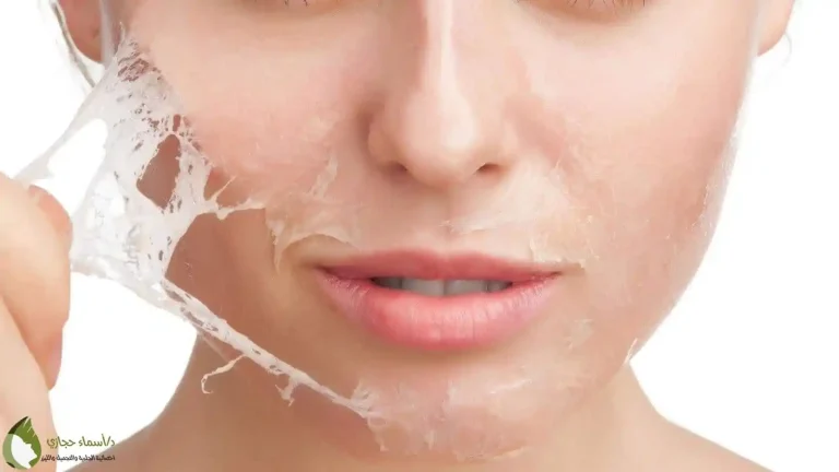 متى اسوي ليزر بعد التقشير؟