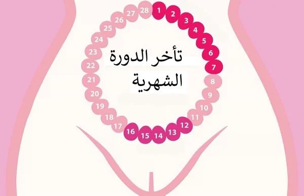 اذا تاخرت الدوره وش اسوي؟